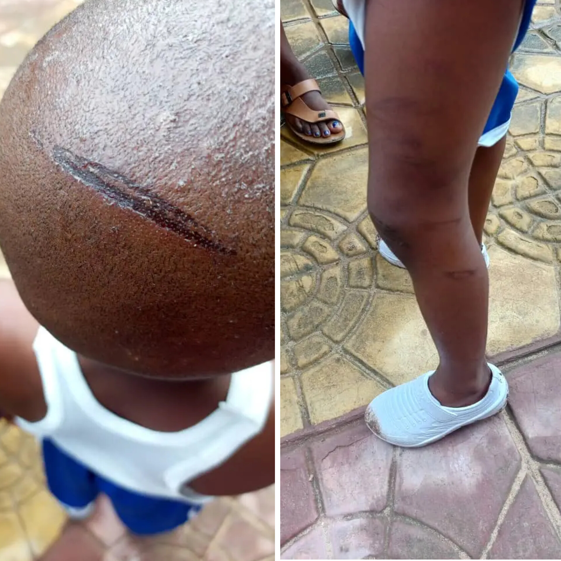 Abia govt rescues minor after assault by parents, father arrested